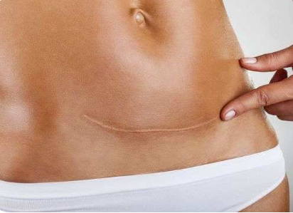 dermopigmentation saint nazaire la baule pornichet